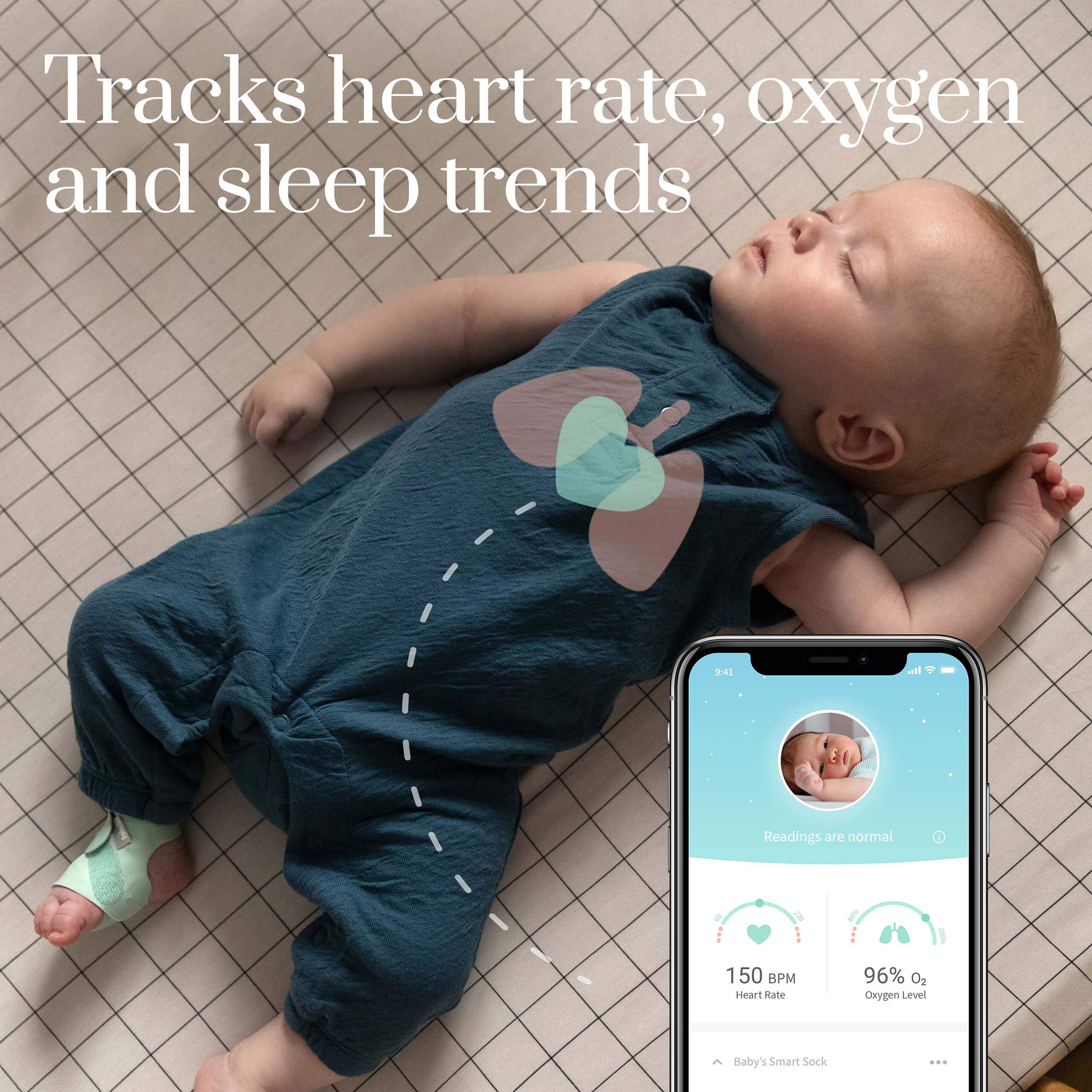 Owlet Smart Sock 3 Baby Monitor - Image 10